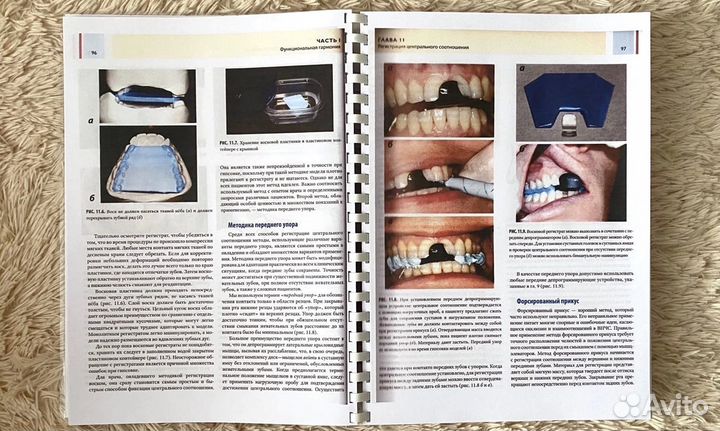 Функциональная окклюзия