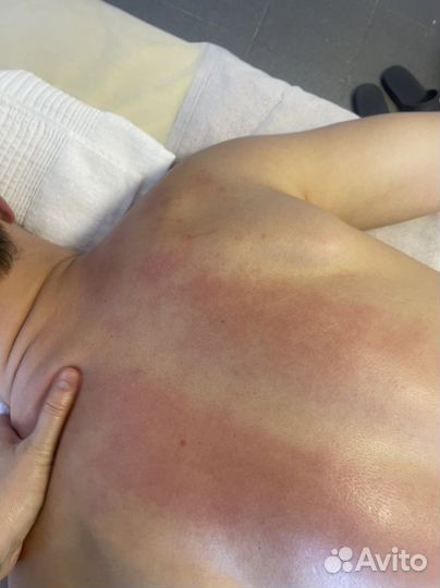 Антицеллюлитный массаж