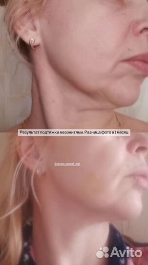 Косметолог - инъекционист