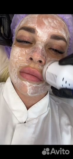 Гигиеническая чистка лица