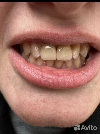 Зубной техник