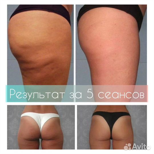 Слёзы бывших - пробный сеанс 