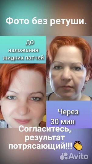 Жидкие патчи