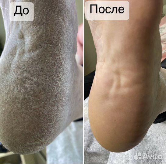 Педикюр подолог, маникюр
