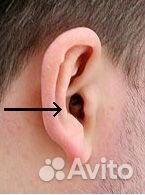 Капсульный микронаушник