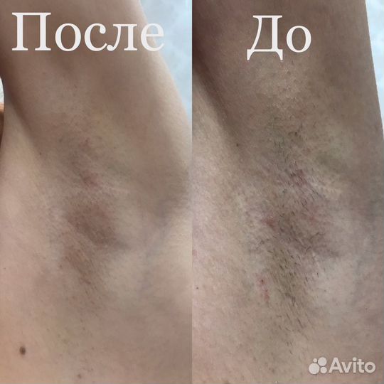 Маникюр, педикюр, шеллак, наращивание. Электроэпил