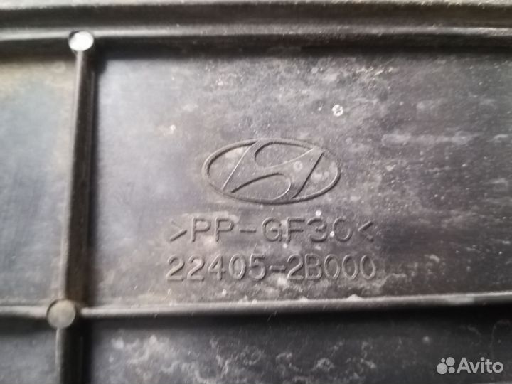 Крышка двигателя декоративная Hyundai Solaris