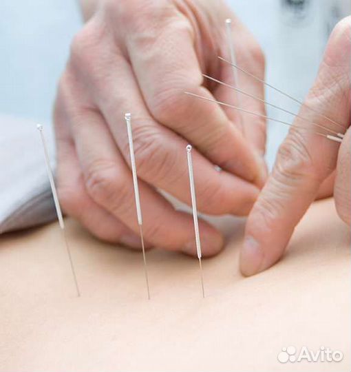 Массаж, банки, гуаша