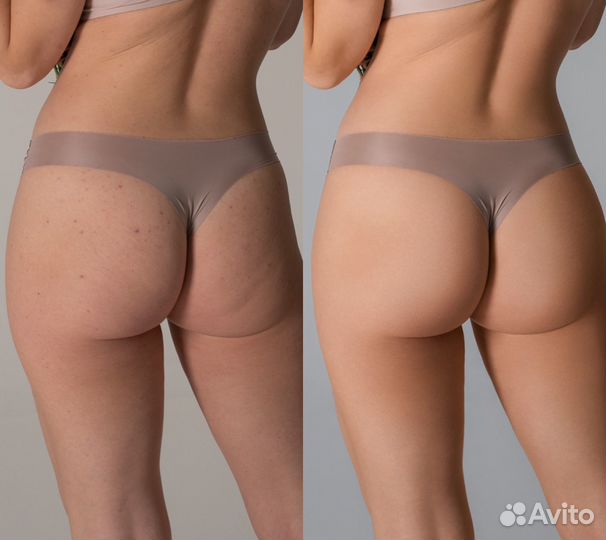 Ретушь и обработка фотографий, ретушер, фотошоп