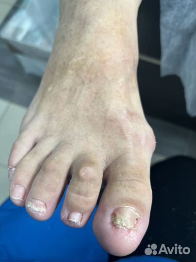 Требуется модели на курсы по подологии