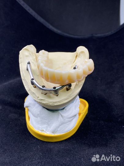 Изготовление анатомической коронки из 3D диоксид ц