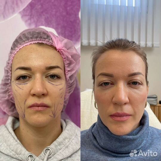 Врач косметолог