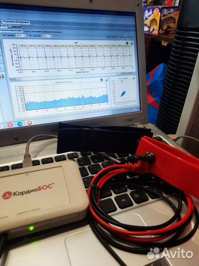 Диагностический терапевтический кардиобос сердце
