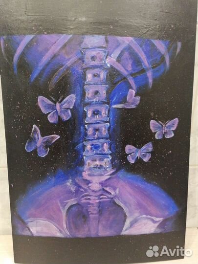 Картина 40 на 60 Бабочки в животе, акрил