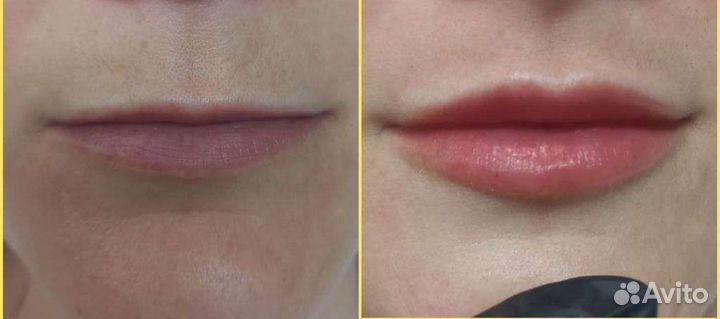 Услуги косметолога