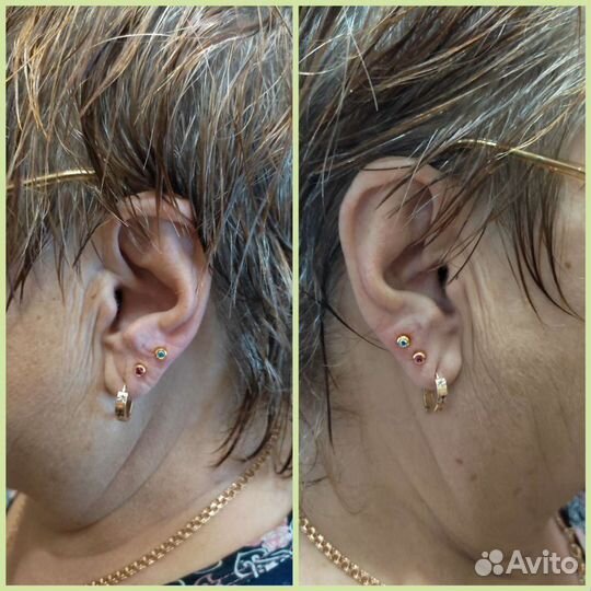 Прокол ушей, хрящ, крыло носа. чтз
