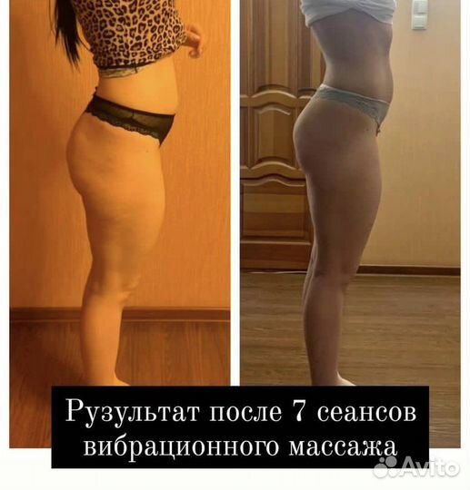 Антицеллюлитный массаж