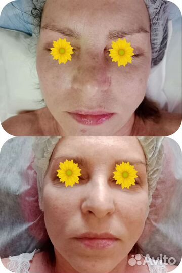 Массаж общий Коррекция фигуры