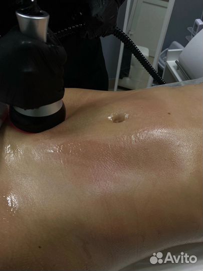 Вакуумный массаж с RF лифтингом