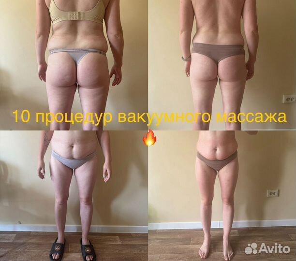 Коррекция фигуры