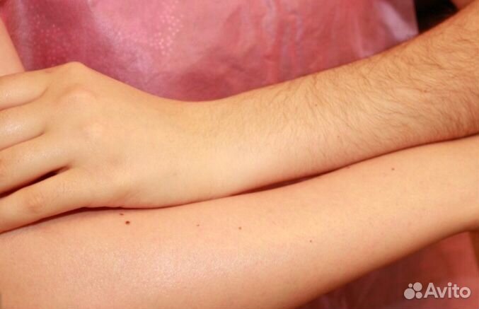 Шугаринг: подбородок