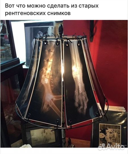 Рентгеновский снимок