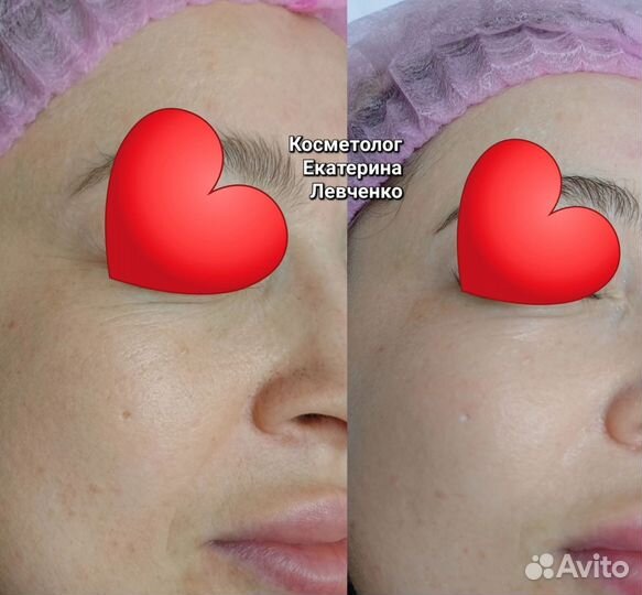 Косметолог. Сорочинск