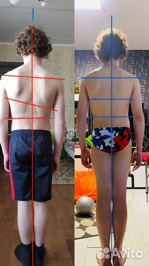 Лфк для детей от 0 до 30 лет