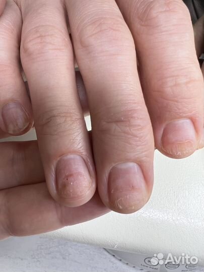 Подолог Бор