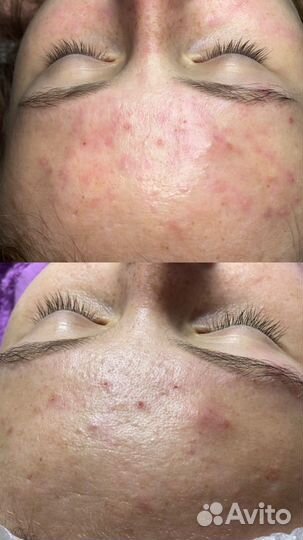 Услуги косметолога