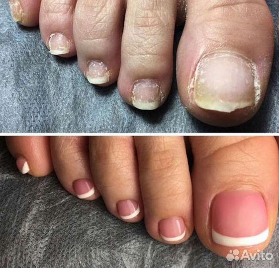 Маникюр гель лак