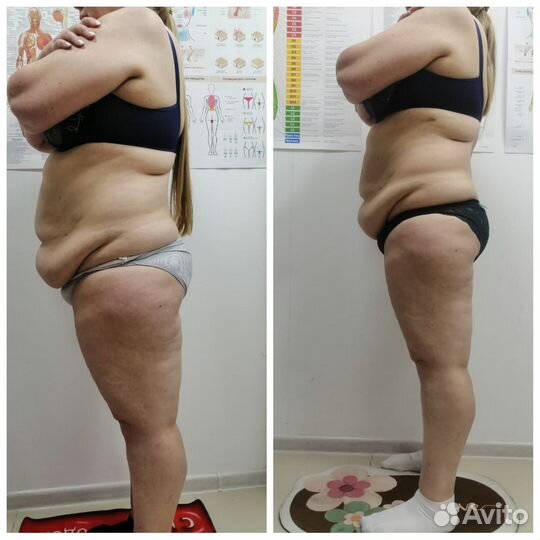 Массаж по уменьшению объёмов тела