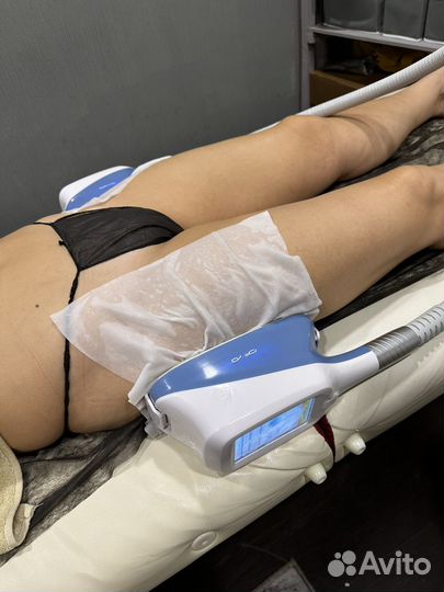 Криолиполиз