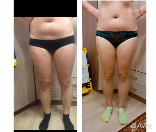 Антицеллюлитный массаж