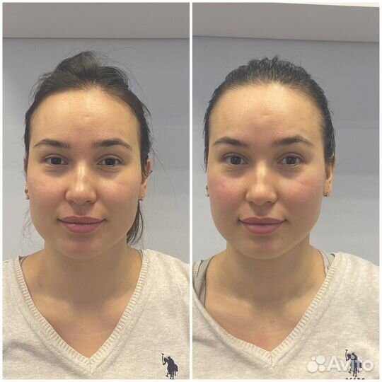 Массаж лица (разные техники)