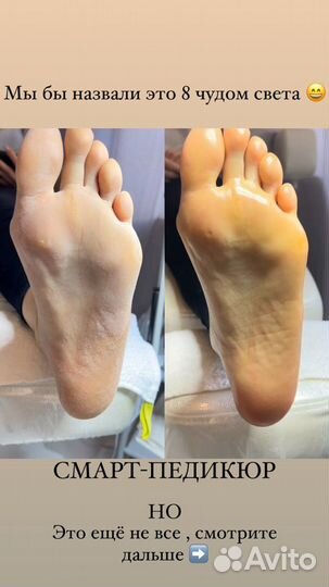 Требуется модель на Маникюр и Педикюр