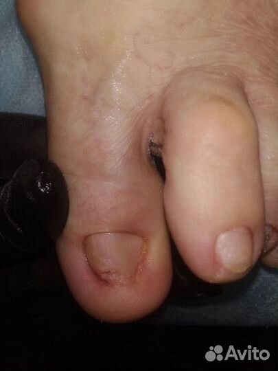 Маникюр педикюр наращивание ногтей