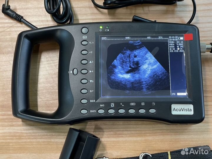Ветеринарный ультразвук сканер AcuVista VT880n