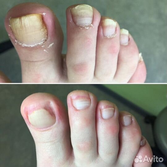 Педикюр маникюр