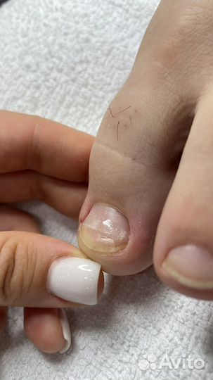 Подологические услуги