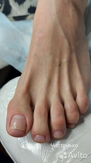 Педикюр