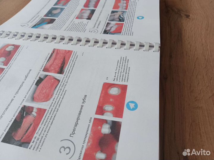 Несъемное протезирование зубов Йошиюки Хагивара