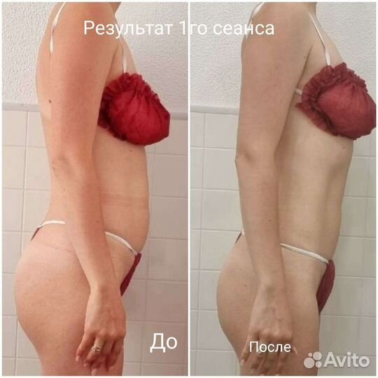 Оздоровительный массаж.Коррекция фигуры. Лицо