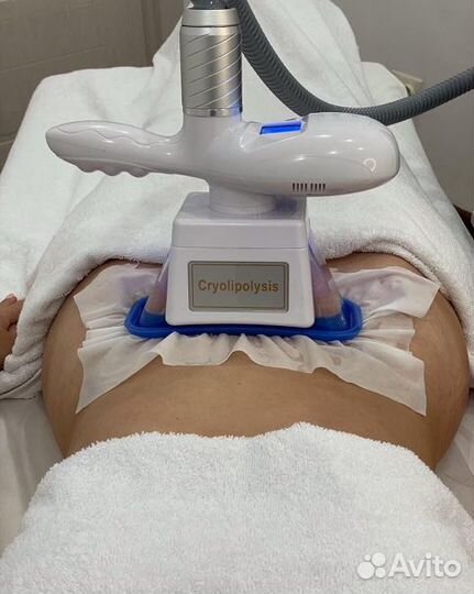 Криолиполиз