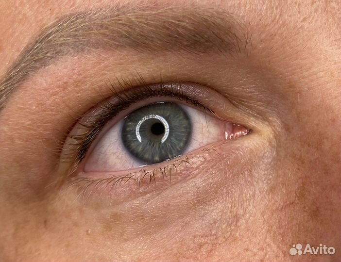 Перманентный макияж. Лазерное удаление пм/ тату