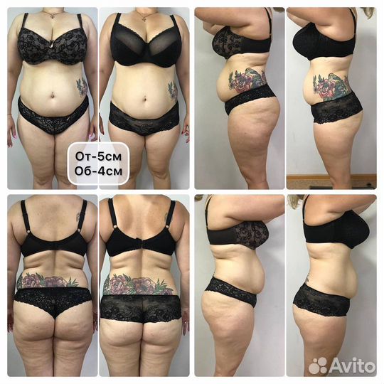 Аппаратное похудение, гарантированный результат