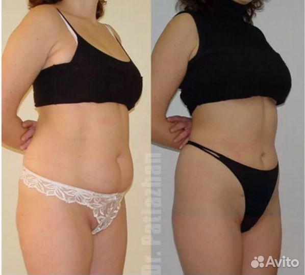 Нужны модели на массаж