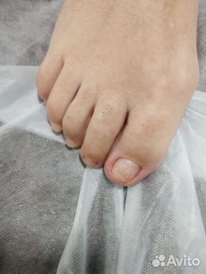 Лечебный педикюр