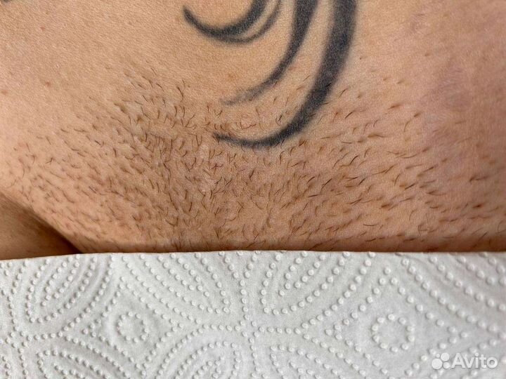 Депиляция воском и сахарной пастой