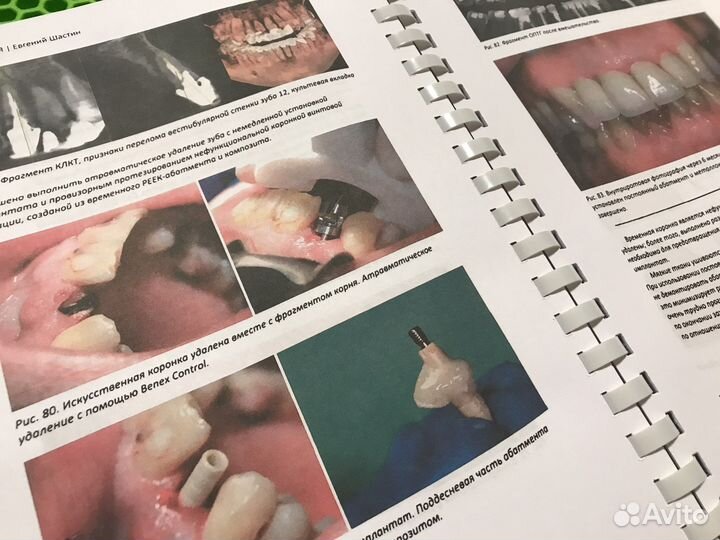 Книги по стоматологии